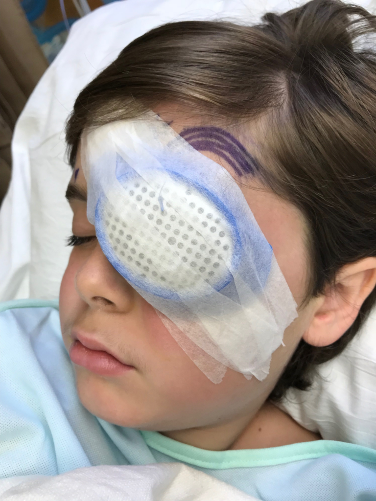 Creed in a hospital bed with an eye patch on his left eye